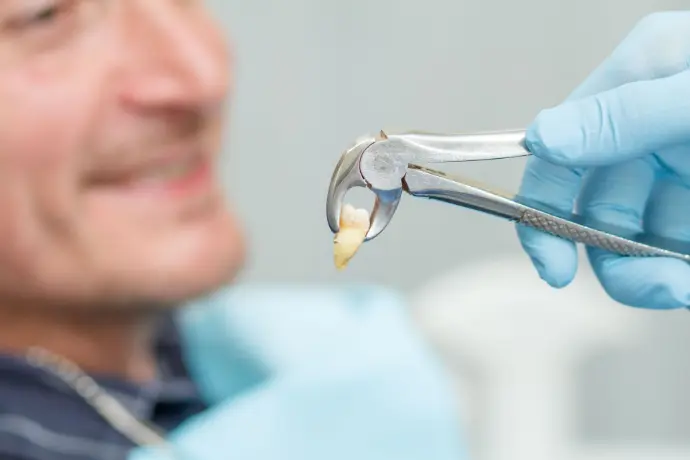 Tooth Extractions Auburn AL