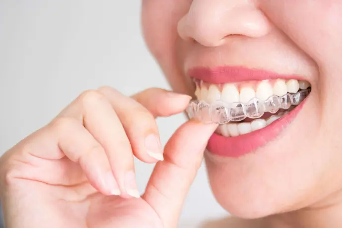 Clear Aligners Auburn AL
